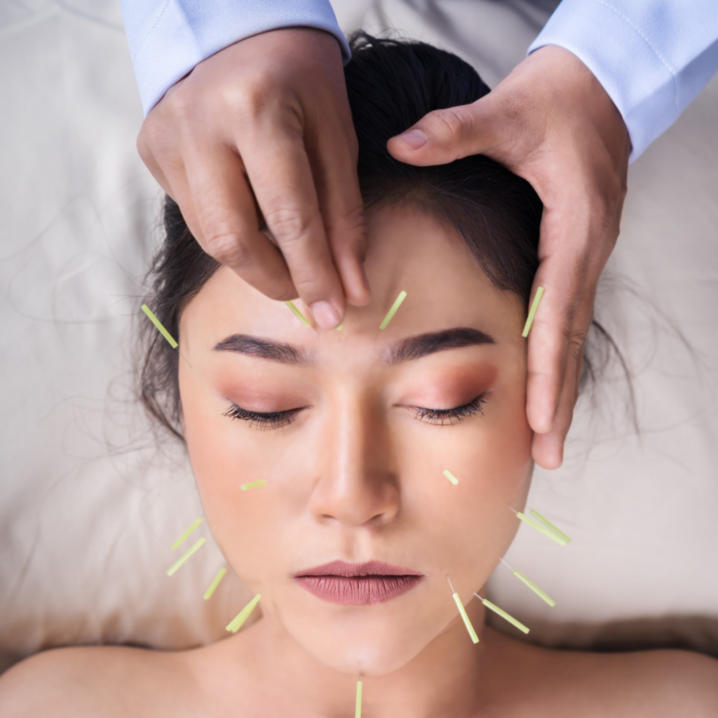 aging, acupuncture, beauty, makeup, wellness