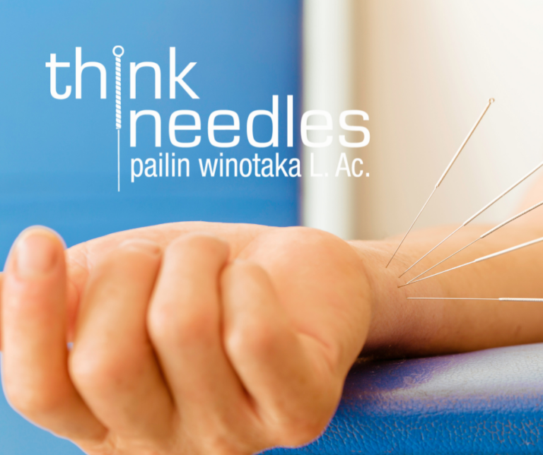 acupuncture needles in the arm of a young person